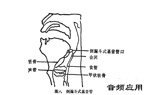 11412535a-0.png